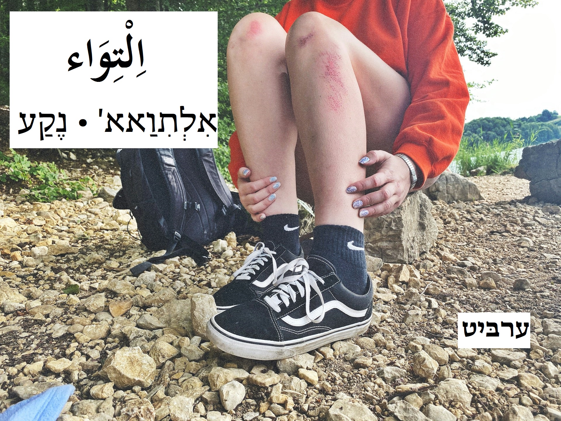 נקע